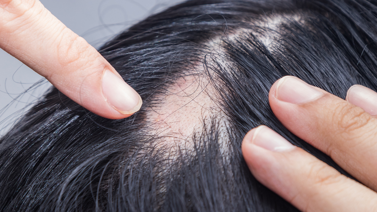MUST Freeze Dried Stem Cell Scalp Serum & Freeze-Dried Powder SET